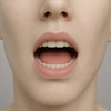 Fixed Tongue