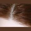 Implanted Synthetic Hair