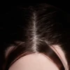 Implant Wigs